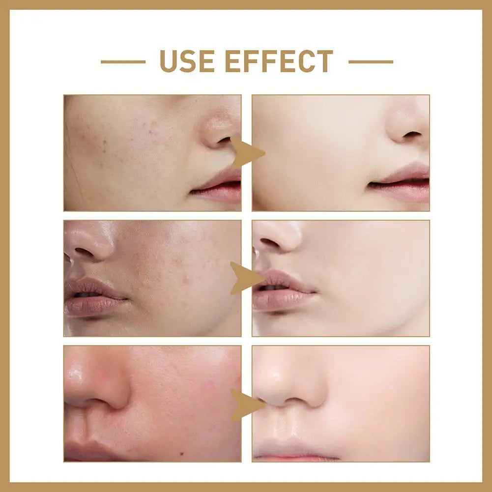 150Ml Rice Face Toner Anti-Aging Moisturizing Essential Toner Facial Skin Care Brighten Improve Fine Line Korean Cosmetics