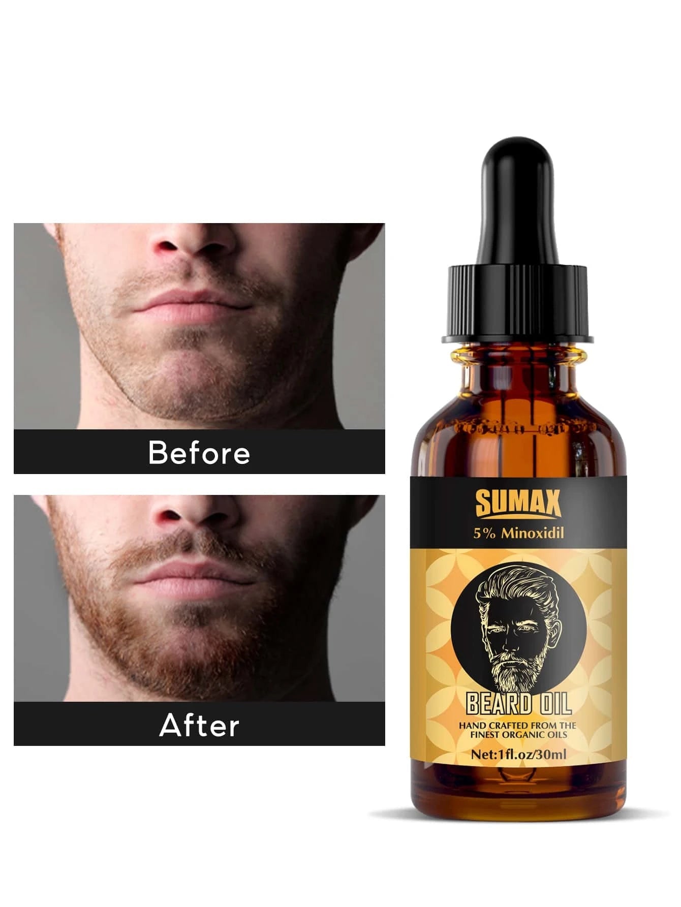 Professional Beard Care Kit with 5% Minoxidil and Smoothing Oil - Achieve a Smooth, Shiny Beard with Derma Roller and Professional Care